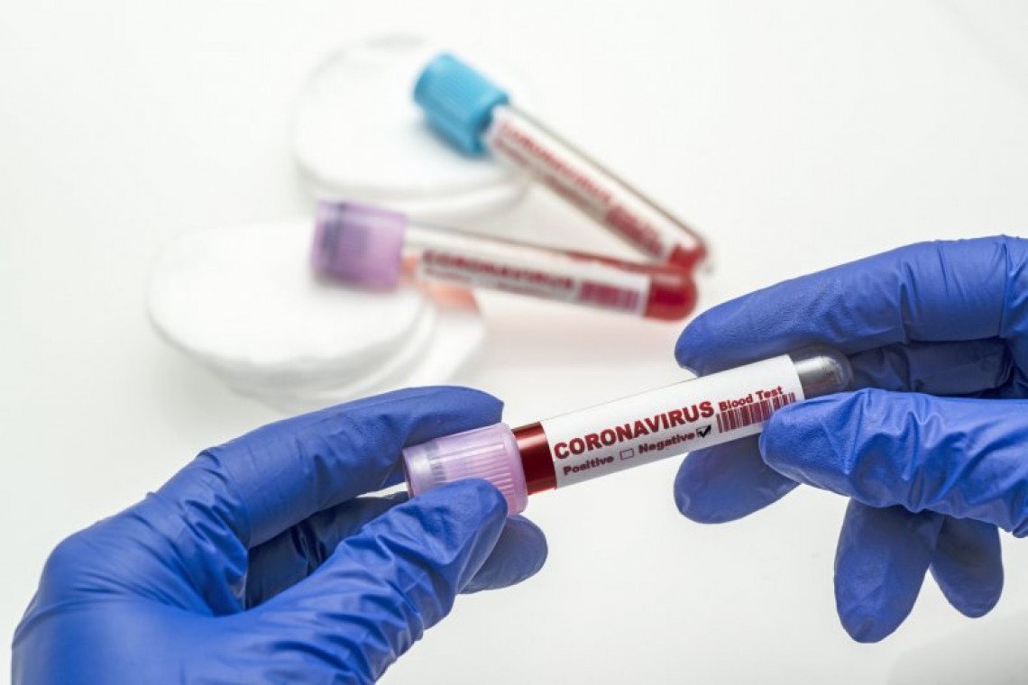 Сдать тест на коронавирус в Краснодаре и получить справку об отсутствии COVID-19. Где?