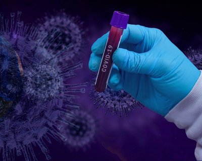 Еще 92 жителя Кубани заразились коронавирусом
